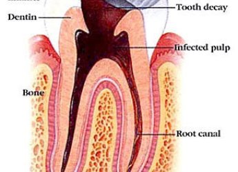 Best Dentist Near Me: Your Ultimate Guide to Dental Health and Expert Care