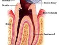 Best Dentist Near Me: Your Ultimate Guide to Dental Health and Expert Care